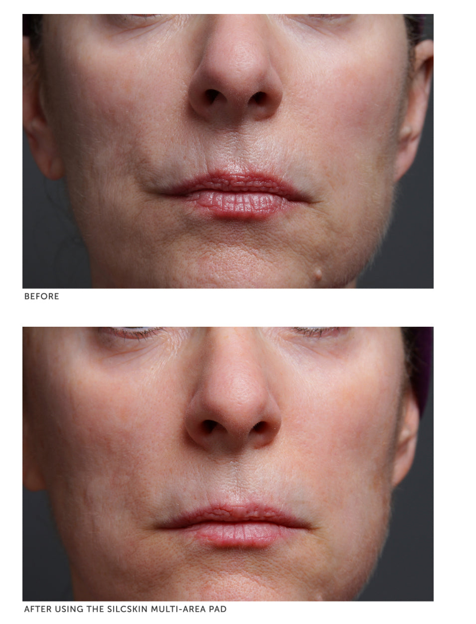 SilcSkin Multi-Area Pads