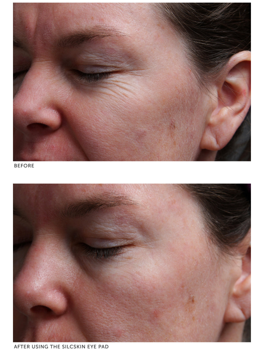 SilcSkin Eye Pad