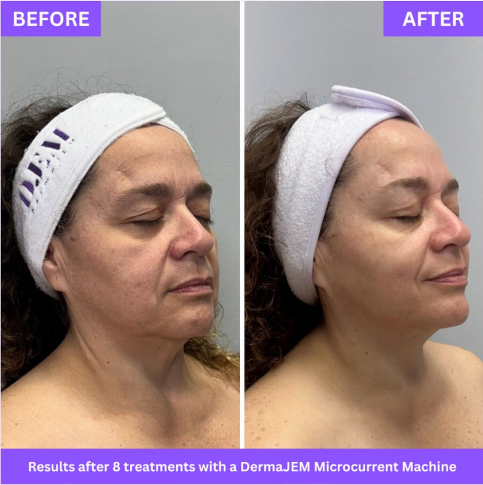 The Power of Microcurrent: Sculpt, Liff & Glow at Trin Spa