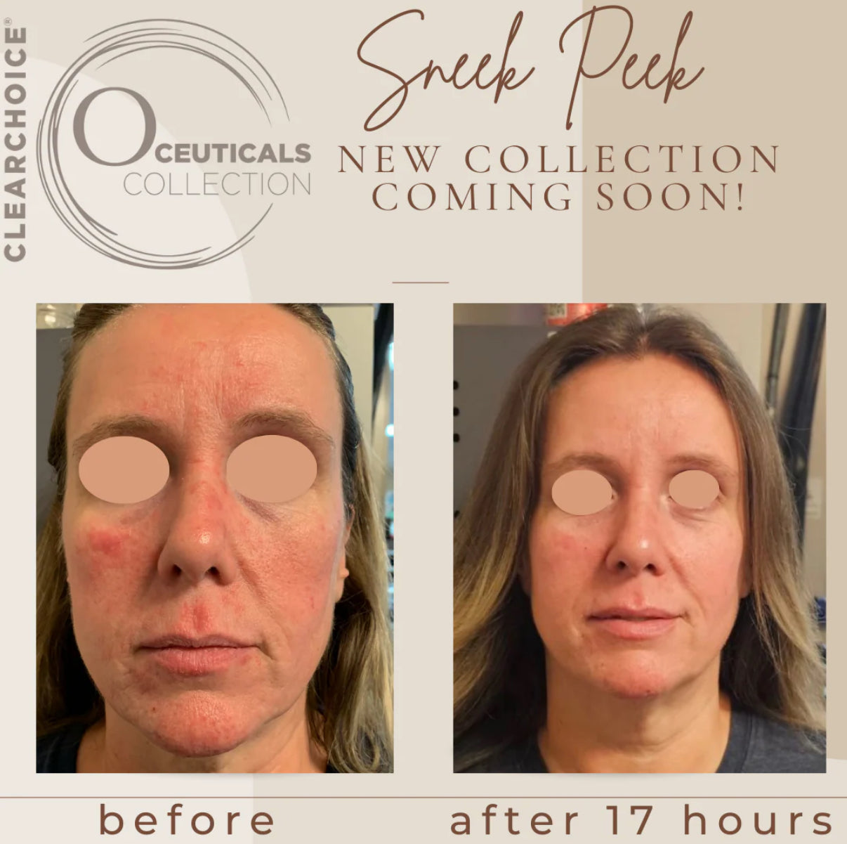 O CEUTICALS COPPERTIDE MIST