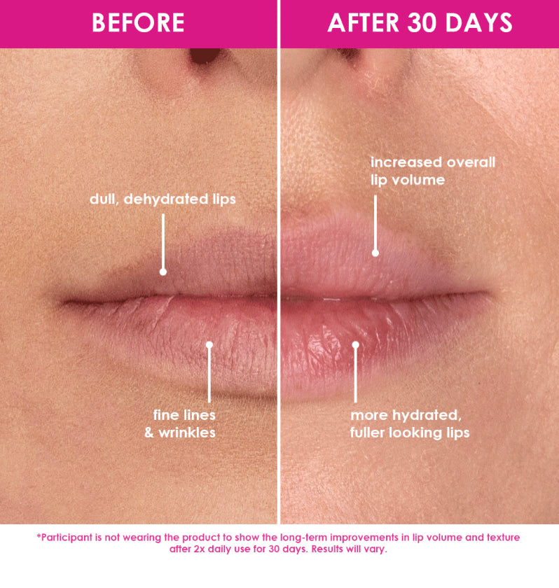 GrandeLIPS Hydrating Lip Plumper | Gloss